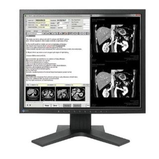 Eizo RadiForce MX194