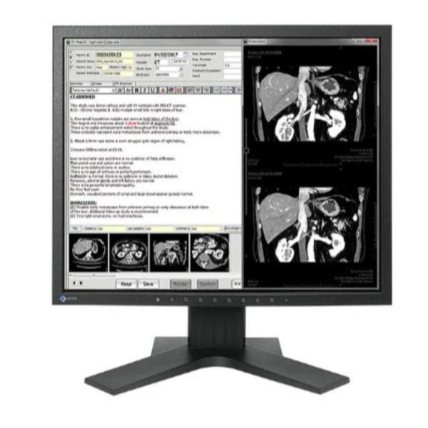 Eizo RadiForce MX194