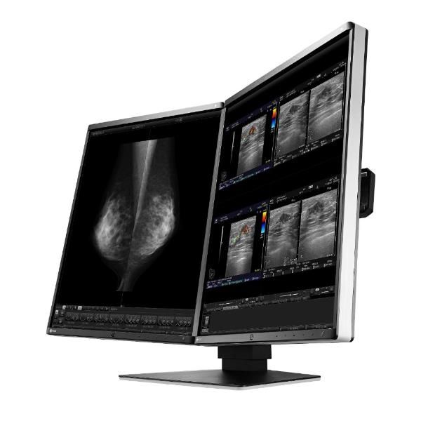 Eizo RadiForce RX560-MD